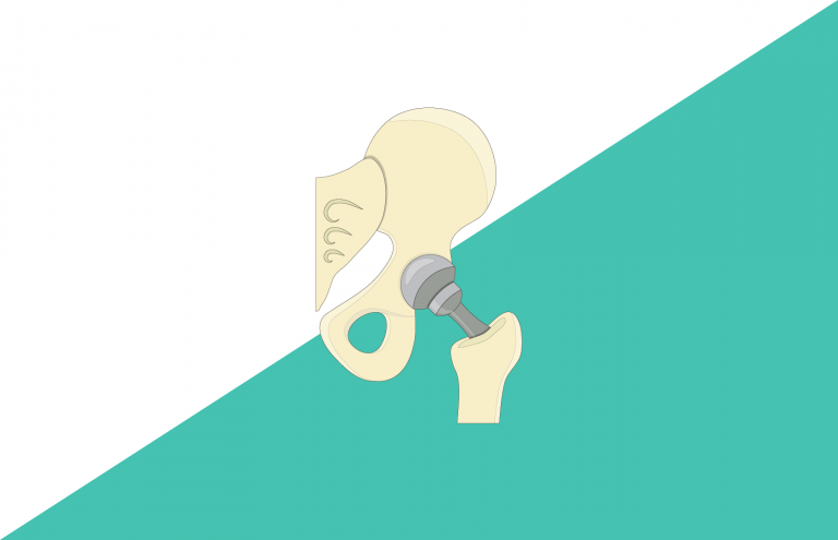 Usage trends of cemented and cementless (uncemented) implants