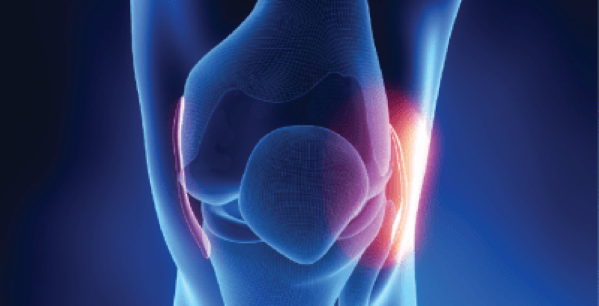 Risk of Medial Collateral Ligament Injury in Knee Arthroplasty