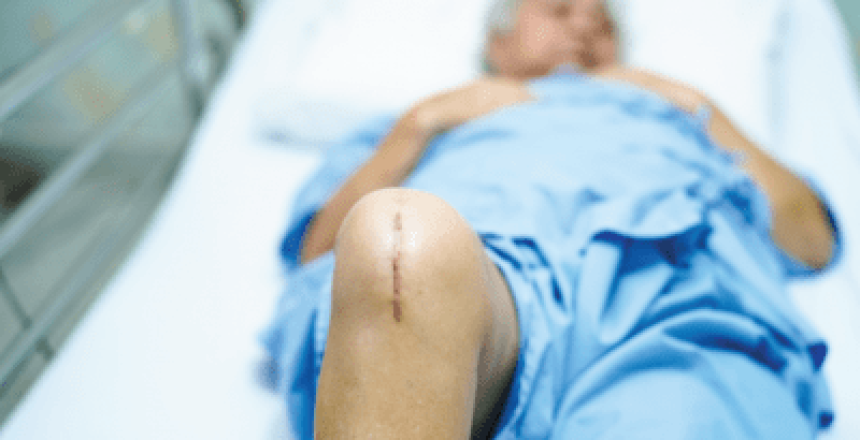 A Cause of Aseptic Loosening and Periprosthetic Joint Infection: Surgical Saw Blade